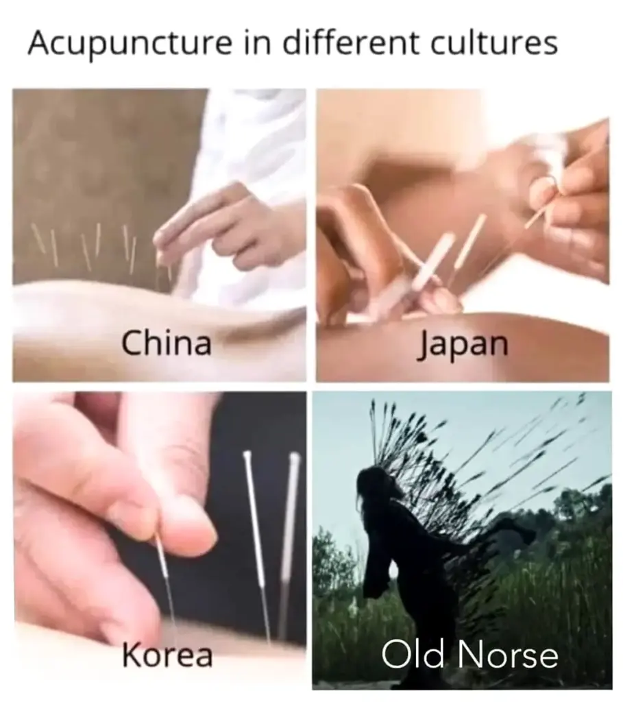 Acupuncture comparison meme with Old Norse twist